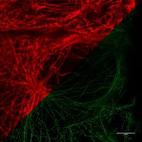 Keratin:  <br>Confocal vs STED